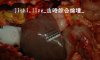 YE0619_15_国内尸检胸腹部被刺的女尸30P 高清图片
